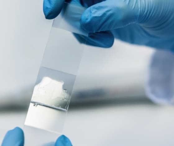 癌検体・組織・FFPE Tissue Samples — ブルーグローブでFFPE組織スライドを保持